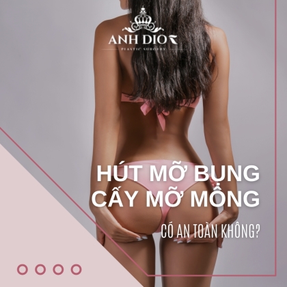 Hút mỡ bụng cấy mỡ mông có an toàn không? - 6 lưu ý cần nhớ