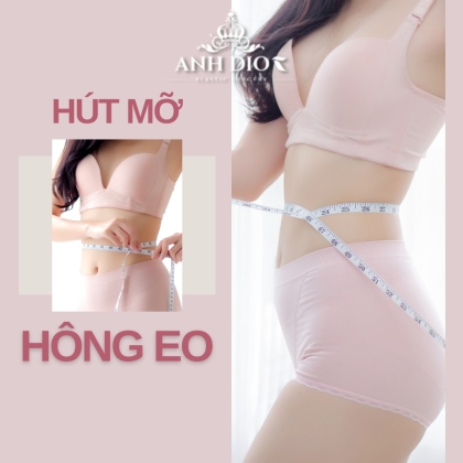 Hút mỡ 2 bên hông, eo - loại bỏ 