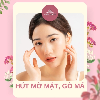 Hút mỡ mặt, gò má - Sỡ hữu gương mặt thanh tú nhanh chóng, an toàn
