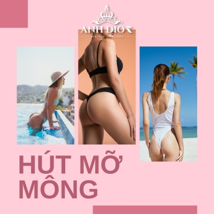 Hút mỡ mông - Sở hữu vòng 3 cân đối, phù hợp