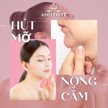 Hút mỡ nọng cằm giá bao nhiêu? Có nguy hiểm không?