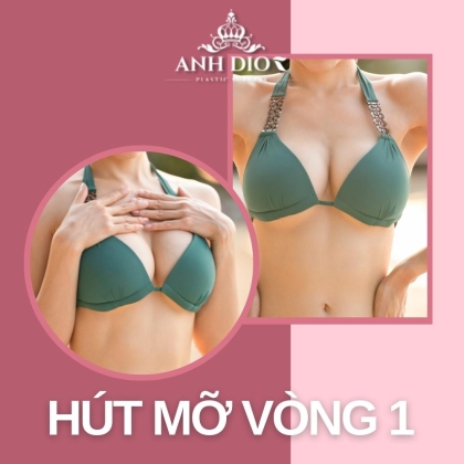 Hút mỡ vòng 1 giá bao nhiêu? Có nên thực hiện không?