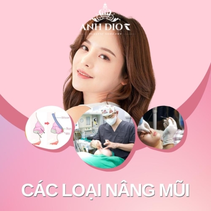 6 loại nâng mũi phổ biến - Nên nâng mũi loại nào tốt nhất 2023?