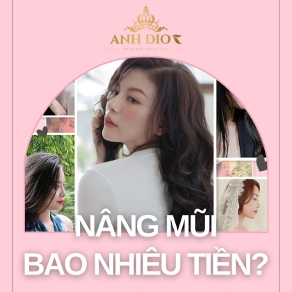 Nâng mũi bao nhiêu tiền? - 4 yếu tố ảnh hưởng, chi phí & bảng giá 2023