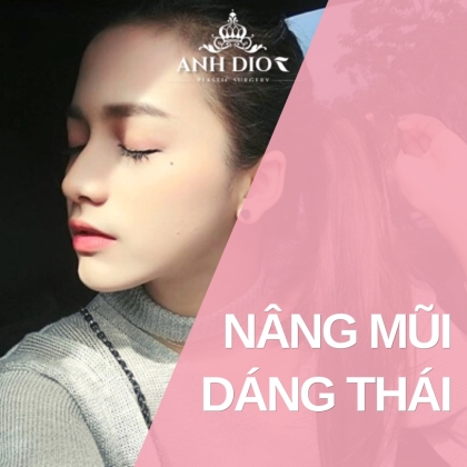 Bạn có phù hợp để nâng mũi dáng Thái? - Dáng mũi lai Hàn Quốc & Châu Âu