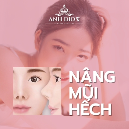 Nâng mũi hếch - Phương pháp nào tối ưu nhất dành cho bạn?