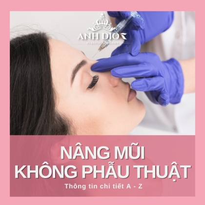 2 loại nâng mũi không phẫu thuật và những điều cần biết