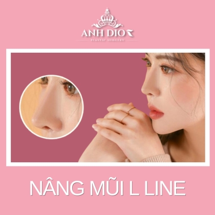Nâng mũi L line là gì? Bạn có phù hợp? Giá bao nhiêu?