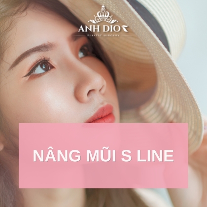 Kinh nghiệm nâng mũi S line - dáng mũi đẹp chuẩn Hàn Quốc