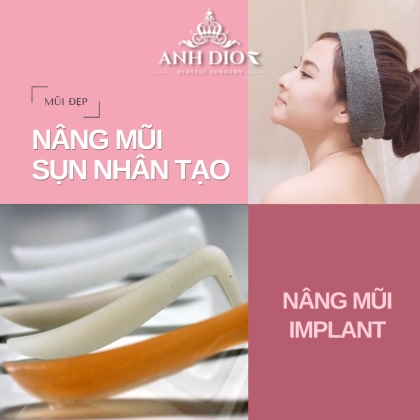 Nâng mũi sụn nhân tạo, nâng mũi implant - Sự thật ít người biết