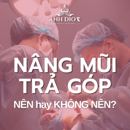 Dịch vụ nâng mũi trả góp - Nên nâng mũi trả góp hay trả 1 lần?