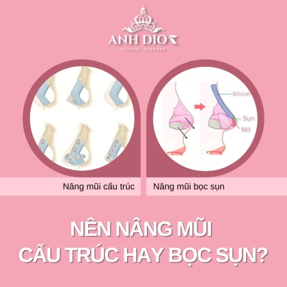 Nên nâng mũi cấu trúc hay bọc sụn? - Hiểu rõ để không nhầm lẫn