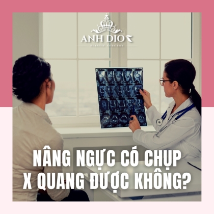 Nâng ngực có chụp X quang được không? 3 quan niệm sai lầm 