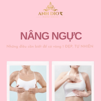 Nâng ngực - Những điều cần biết để có vòng 1 ĐẸP và TỰ NHIÊN