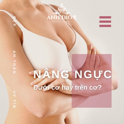 Nâng ngực dưới cơ là gì? Nên nâng ngực dưới hay trên cơ?