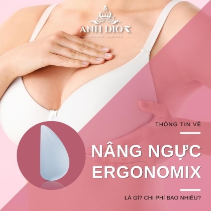 Nâng ngực Ergonomix - Túi Ergonomix có tốt không? Giá bao nhiêu?