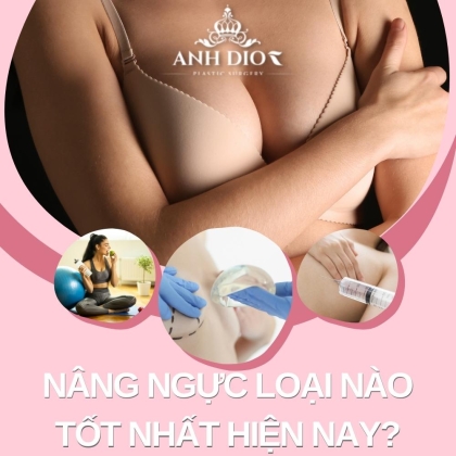 Nâng ngực loại nào tốt nhất hiện nay? - Top 7 và ưu nhược điểm