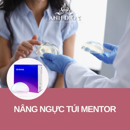 Có nên nâng ngực túi Mentor? Nâng ngực mentor giá bao nhiêu?