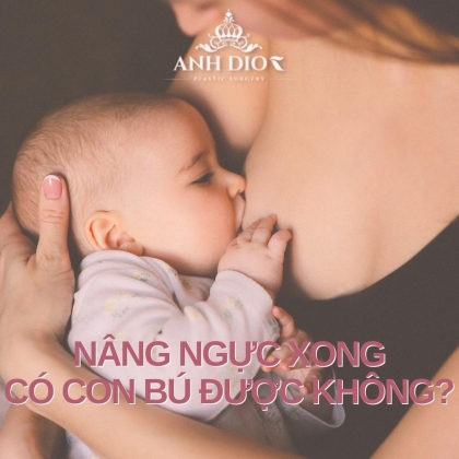 Nâng ngực xong có cho con bú được không? - Giải đáp A - Z
