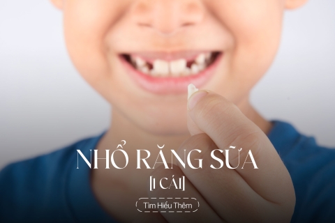 Nhổ răng sữa
