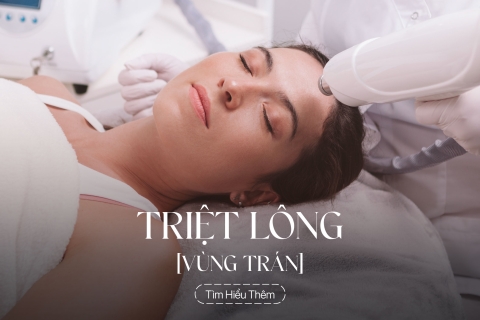 Triệt lông vùng trán