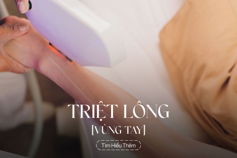 Triệt lông vùng chân