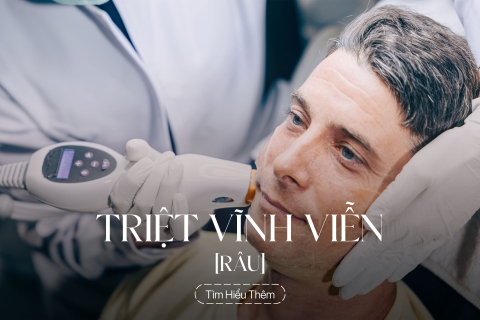 Triệt râu vĩnh viễn