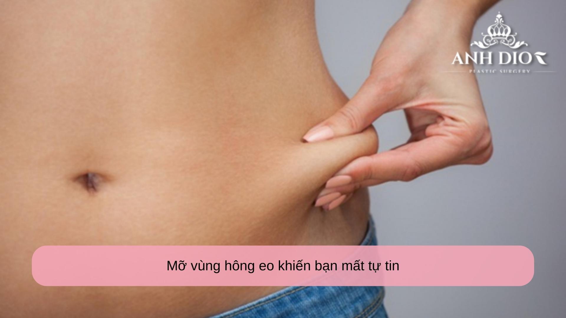 Hút mỡ eo, 2 bên hông