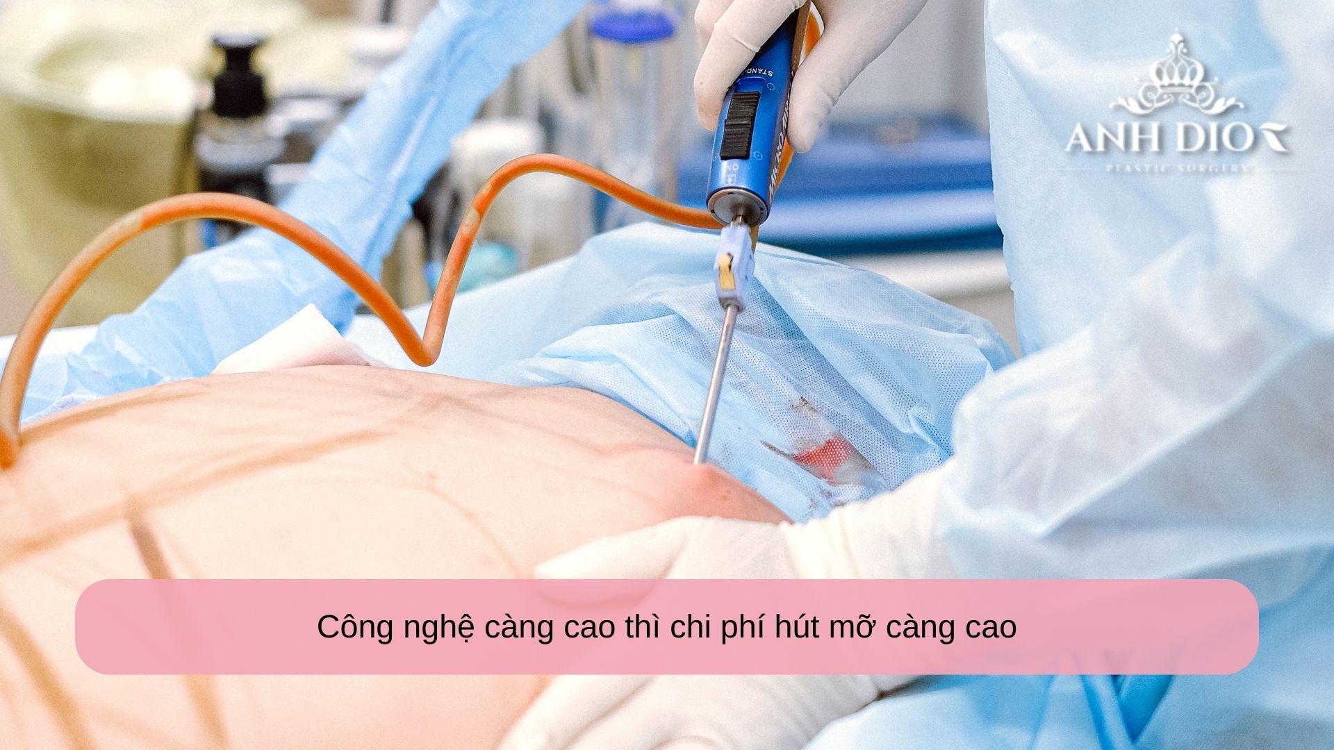 Chi phí hút mỡ