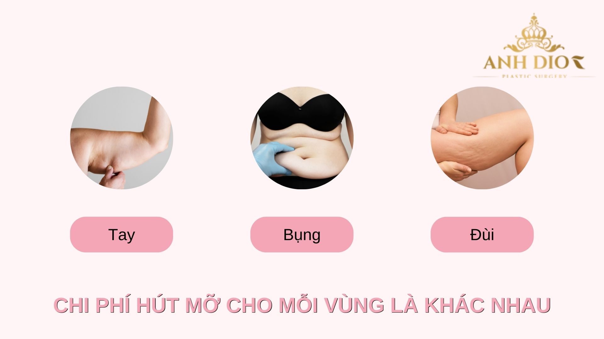 Hút mỡ giá bao nhiêu