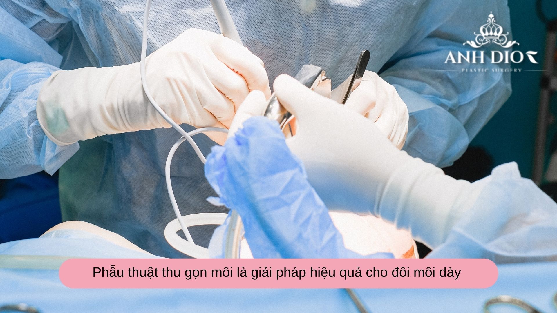 Hút mỡ môi