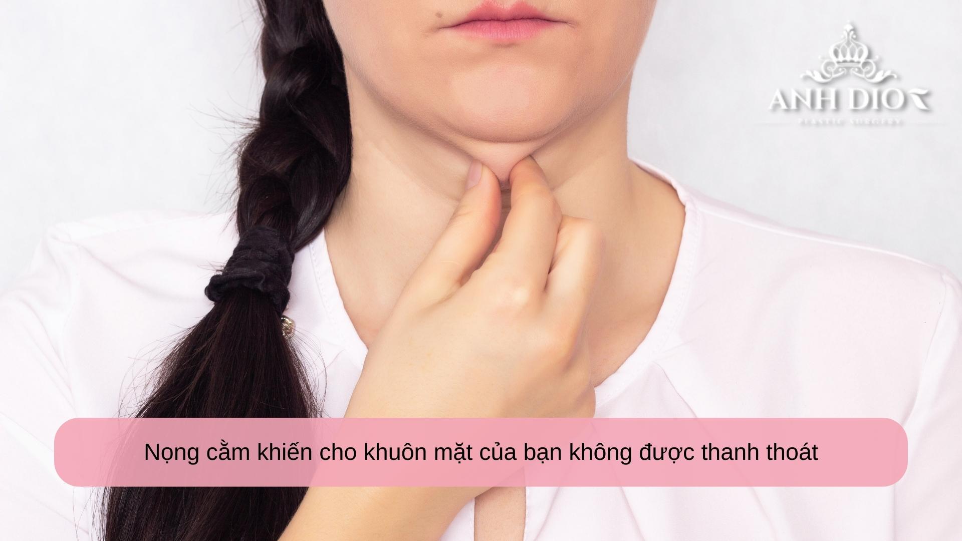 Hút mỡ nọng cằm