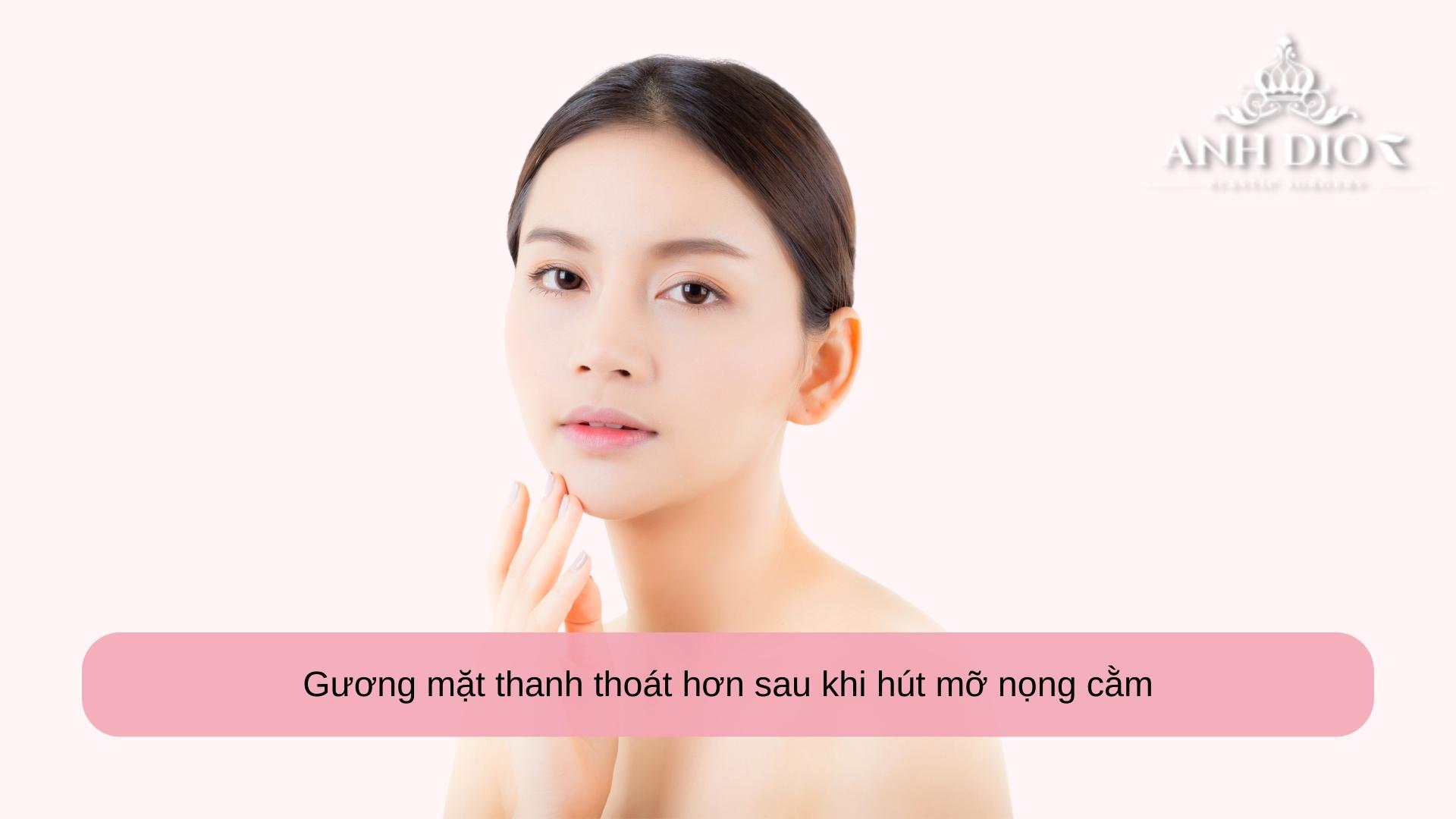 Hút mỡ nọng cằm