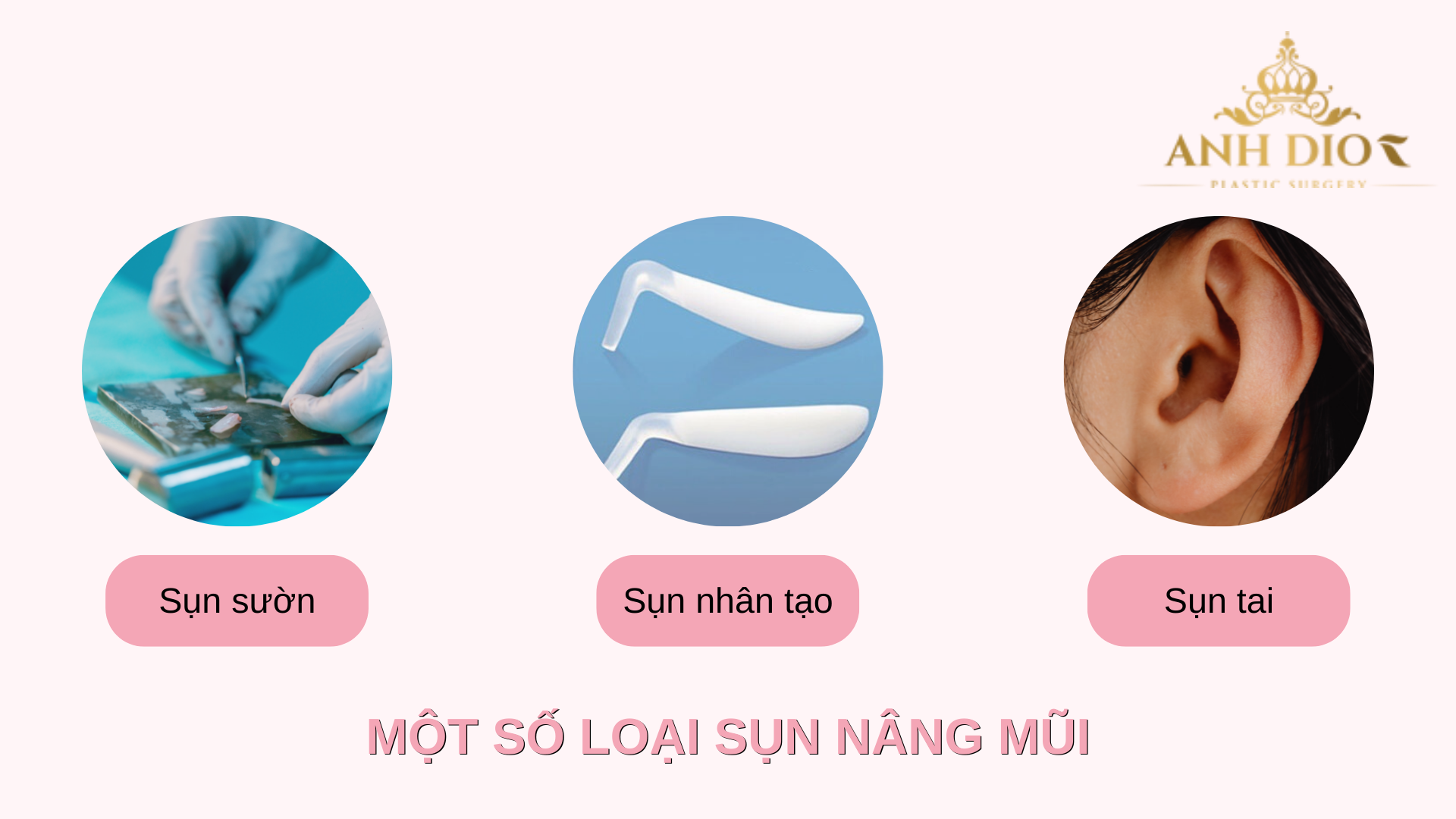 Các loại sụn nâng mũi cấu trúc