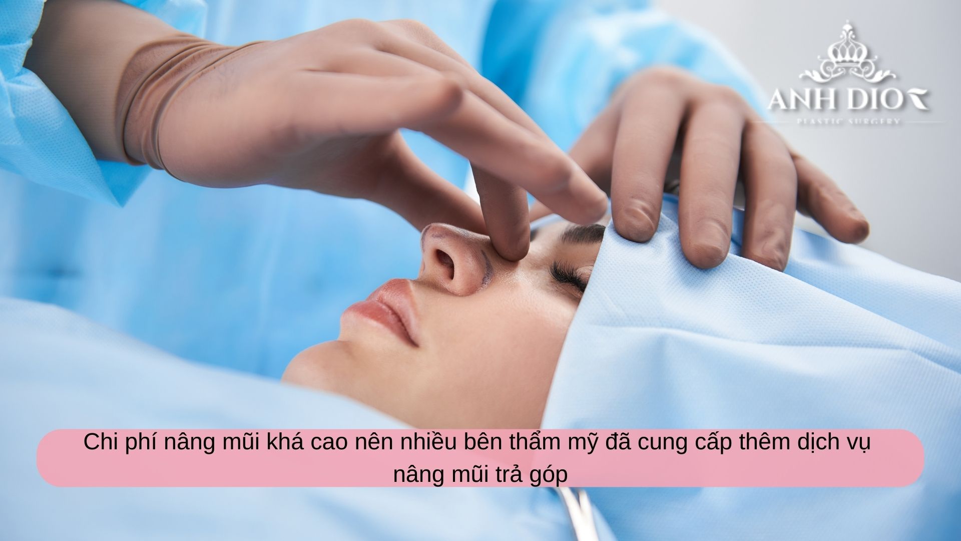 Nâng mũi trả góp