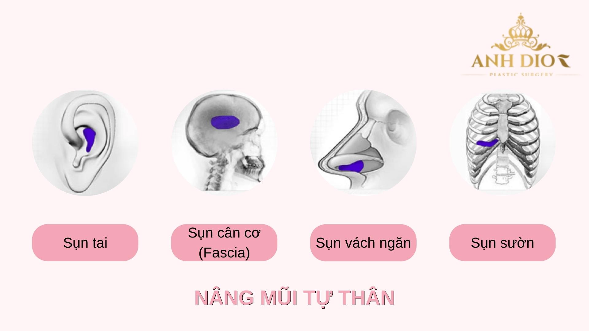 Nâng mũi tự thân