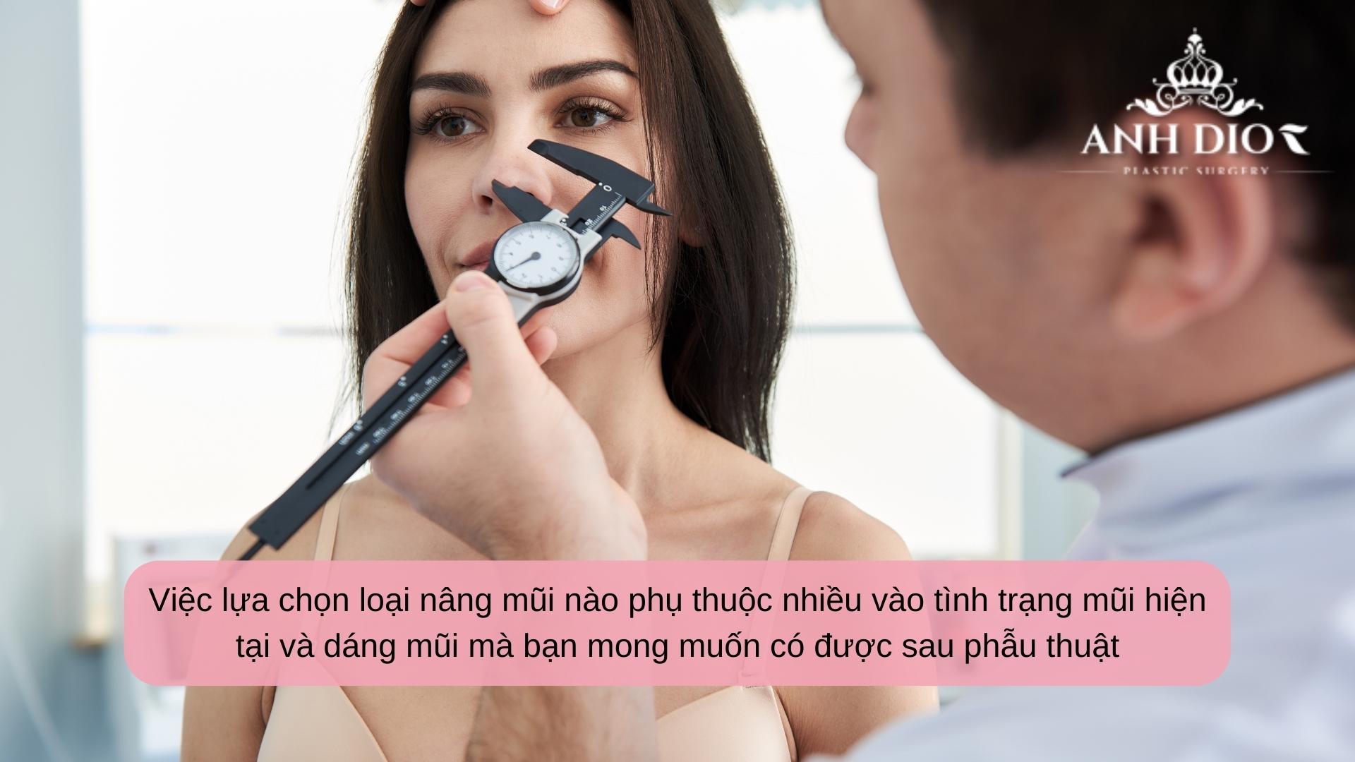 Nên nâng mũi cấu trúc hay bọc sụn