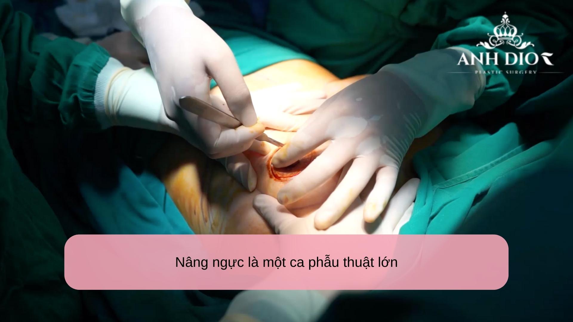 Phẫu thuật nâng ngực