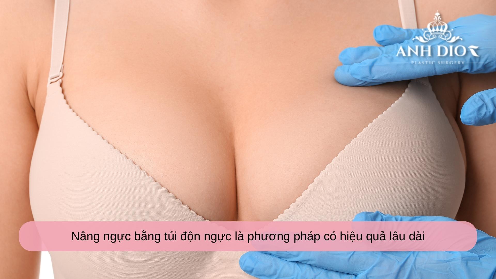 Nâng ngực có được vĩnh viễn không