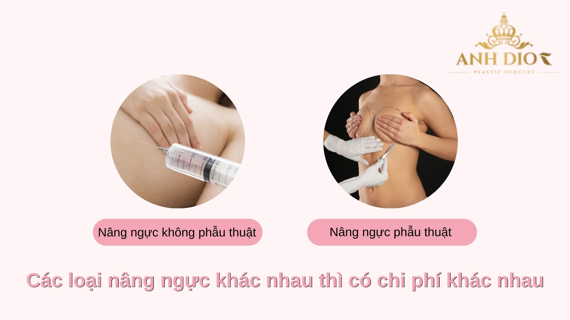 Nâng ngực giá bao nhiêu