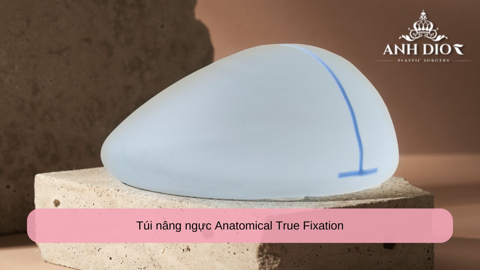 Túi nâng ngực Anatomical True Fixation