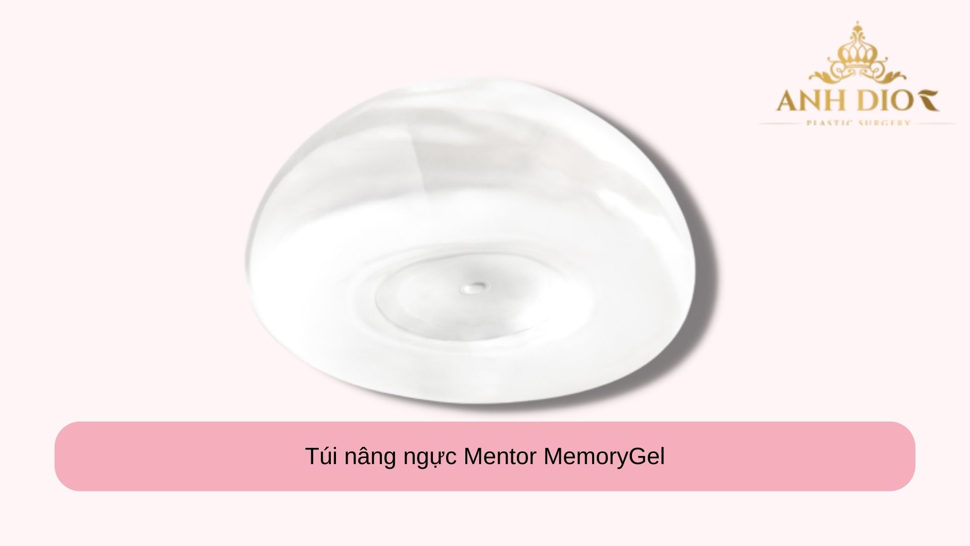 nâng ngực túi mentor