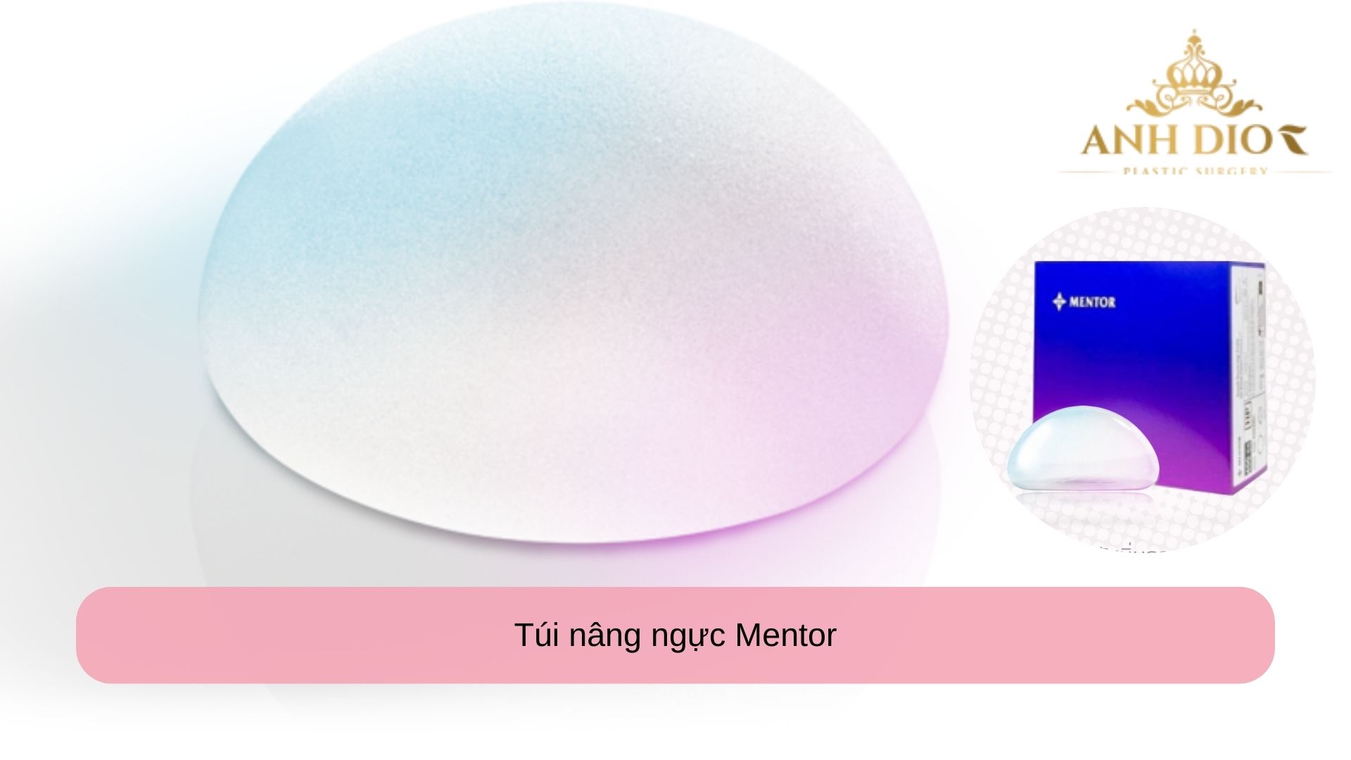 nâng ngực túi mentor