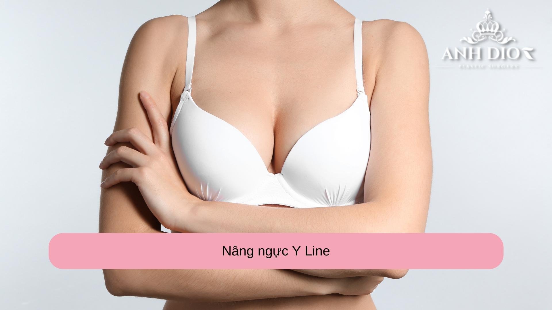 Nâng ngực Y line