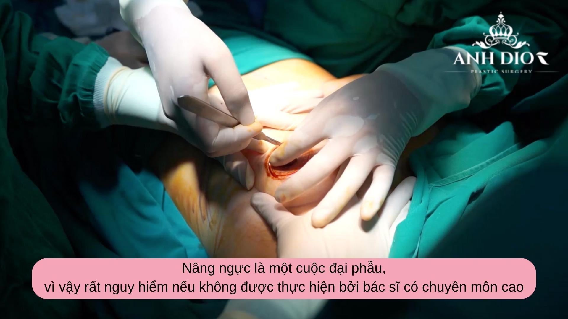 Phẫu thuật nâng ngực có nguy hiểm không